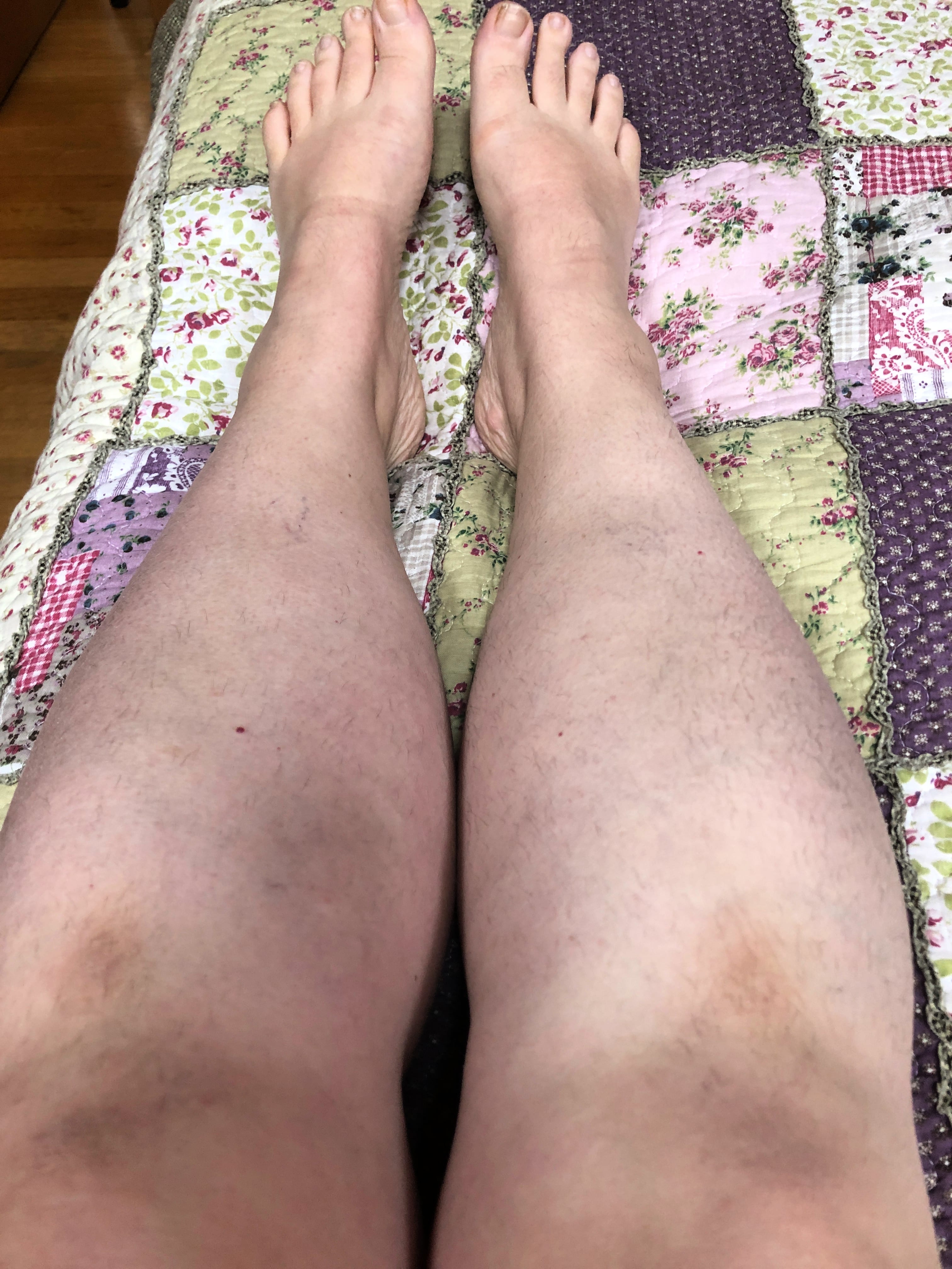 Legs 7 April 2019