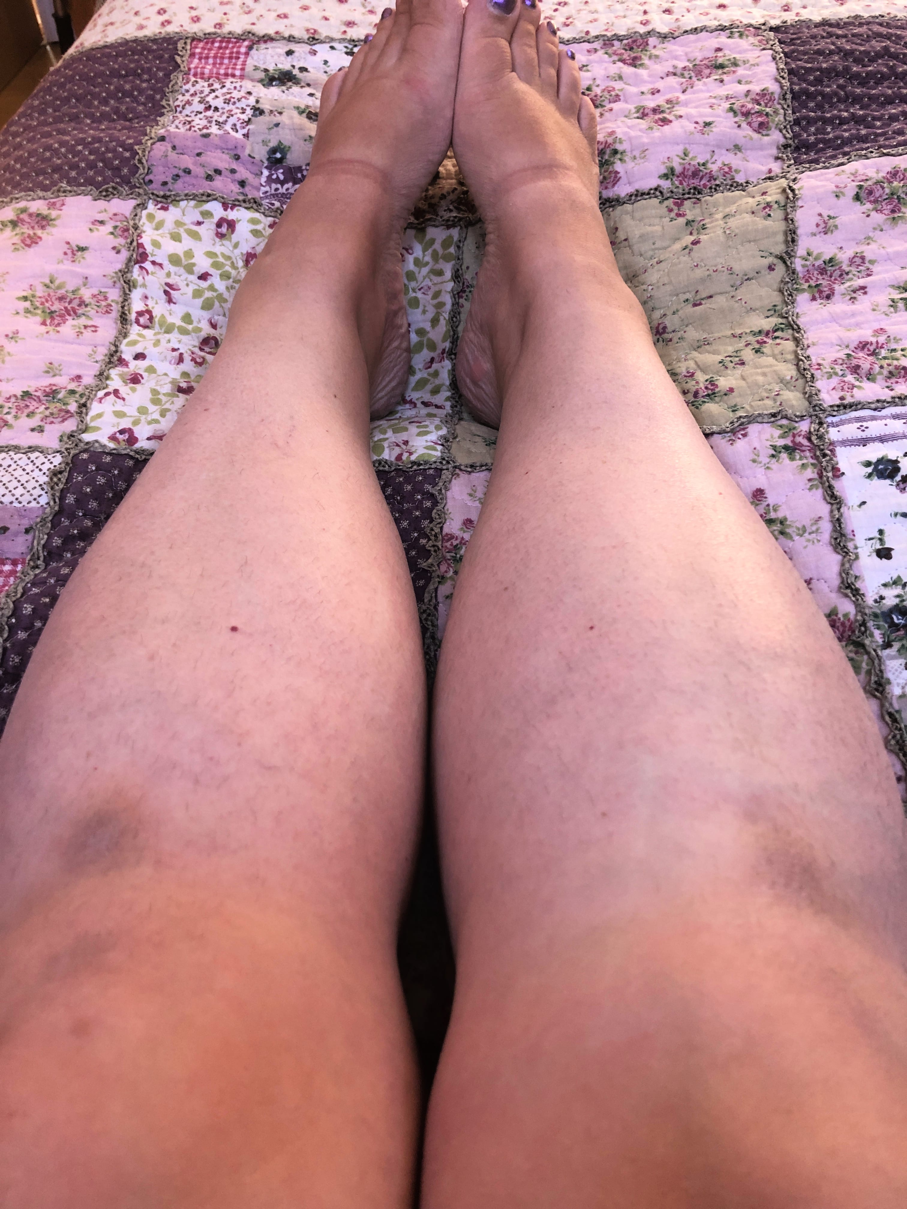 Legs August 2019