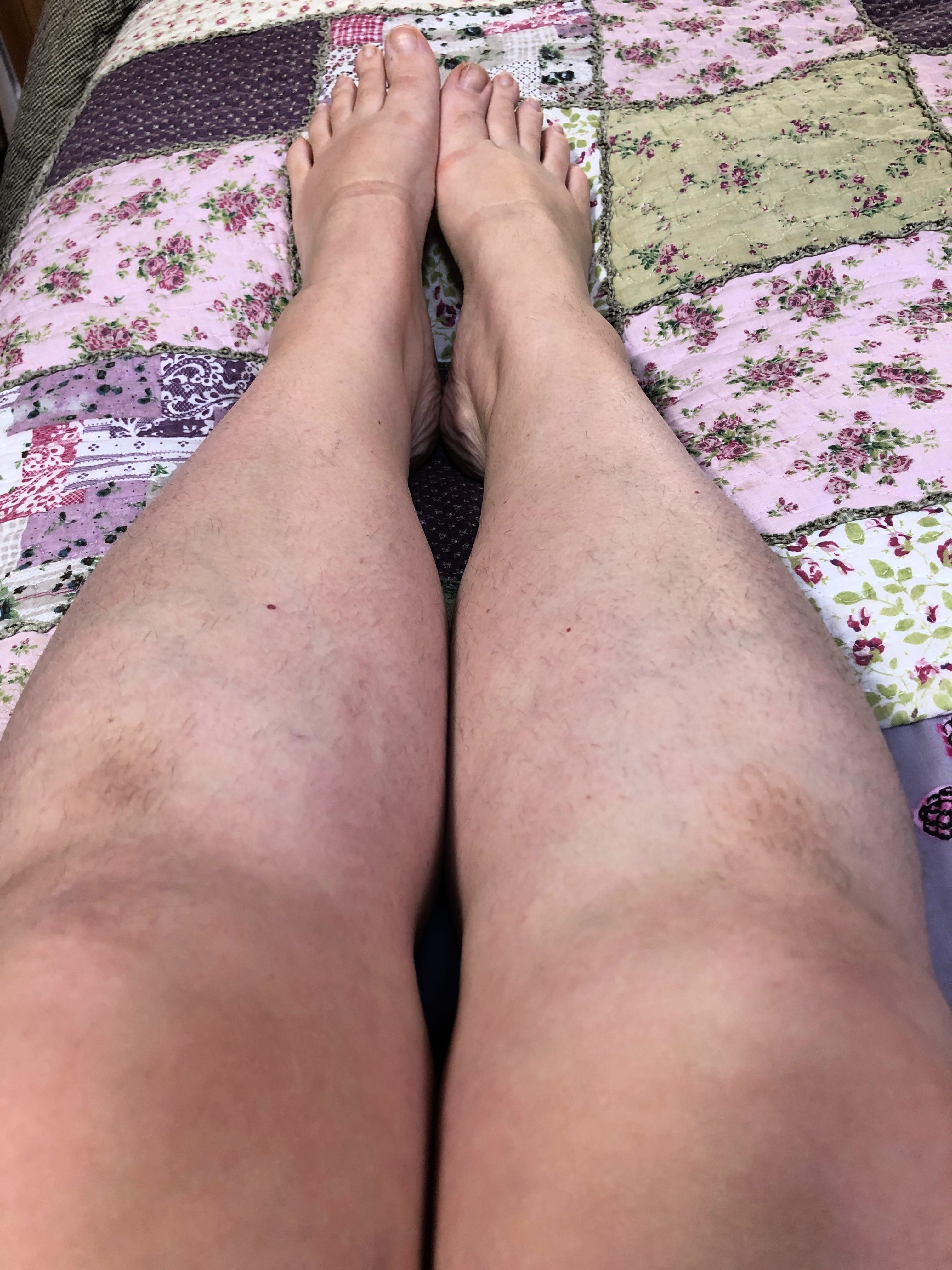 Legs March 2019